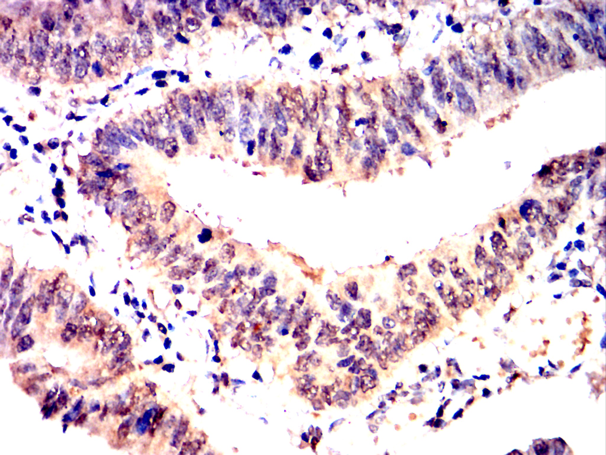 IHC